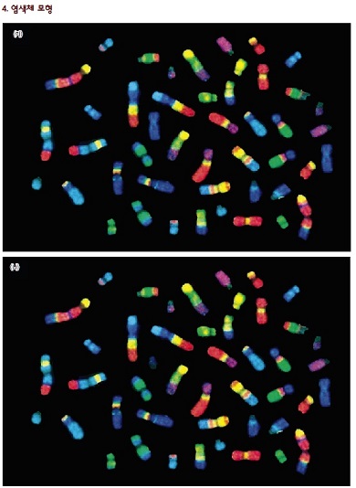 염색체 사진