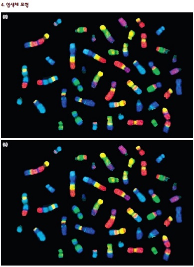 염색체 사진